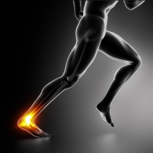 Achilles Tendinopathy